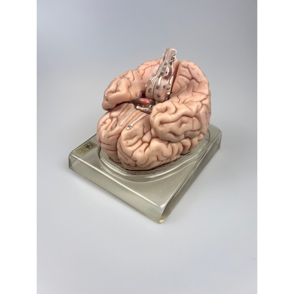 Vintage Somso Germany Anatomical Teaching Model | Human Brain | 6 Parts | Oddity - Picture 2 of 9